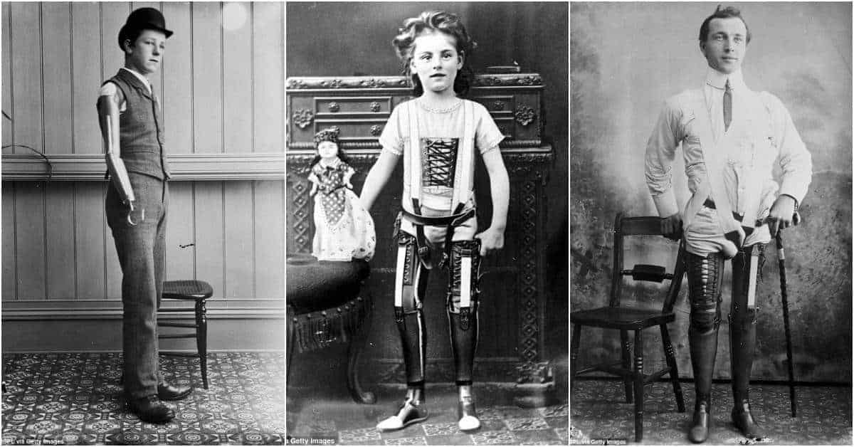 Vintage Photographs of Artificial Limbs will Change the Way You See them Forever