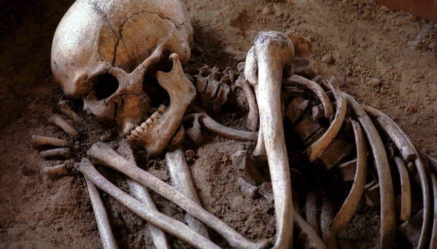 10 Human Skeletons with Ghastly Tales to Tell